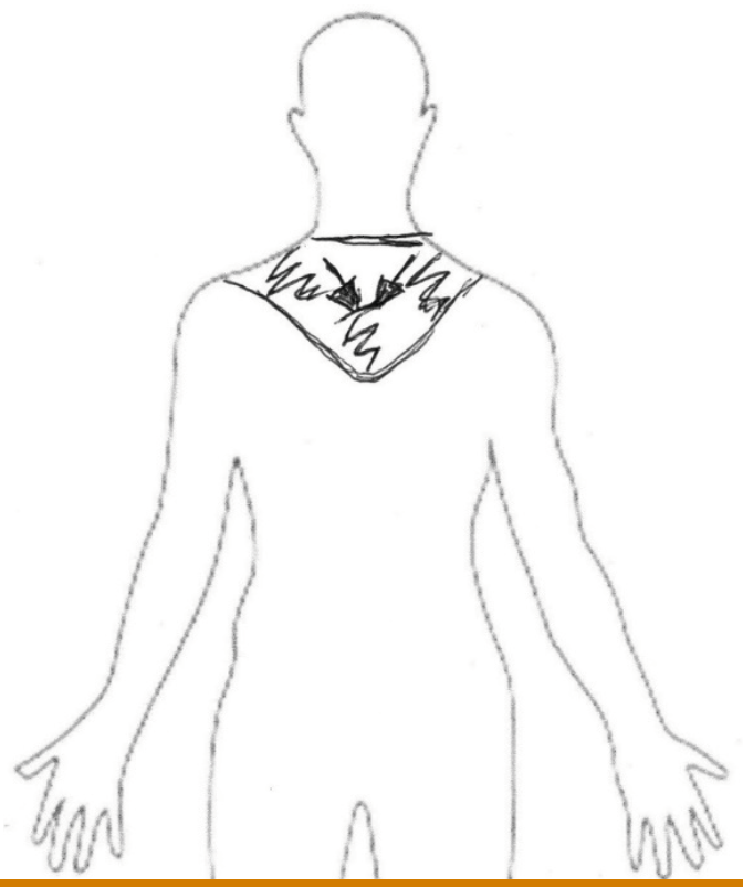 Referencia analógica de sensaciones experimentadas en episodio 18