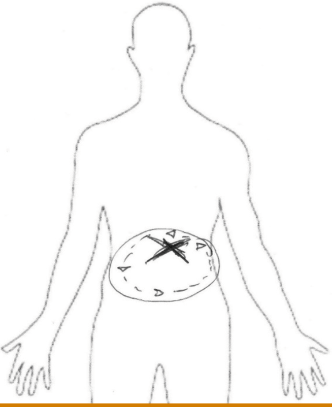 Referencia analógica de sensaciones experimentadas en episodio 17
